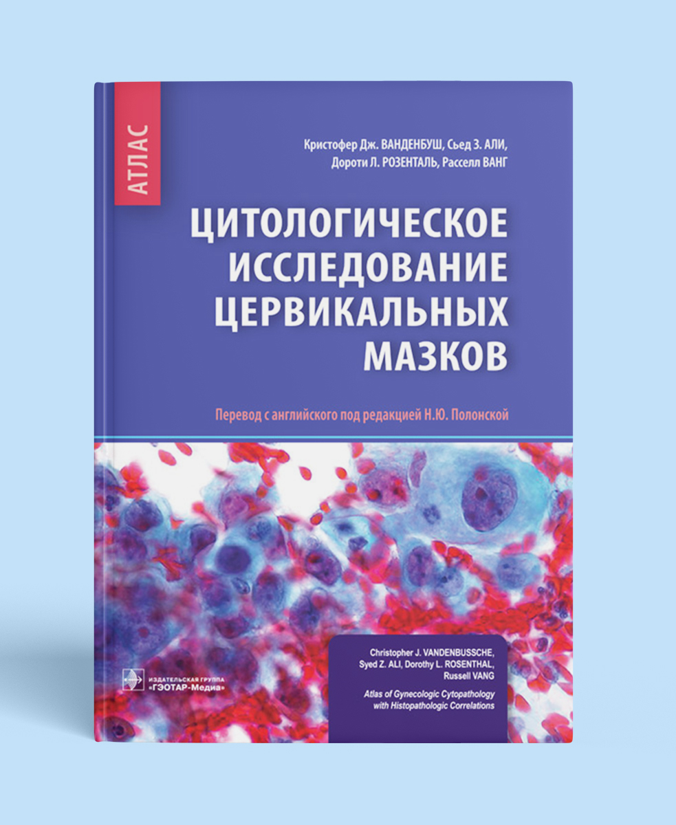 Цитологическое исследование цервикальных мазков: атлас 
